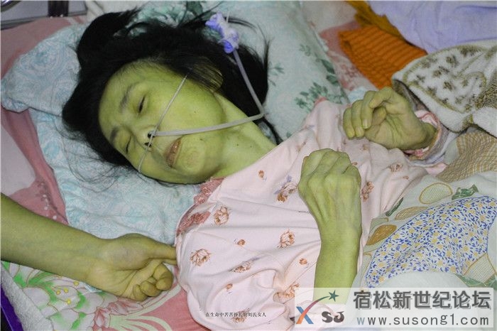 每天不间断的抽搐