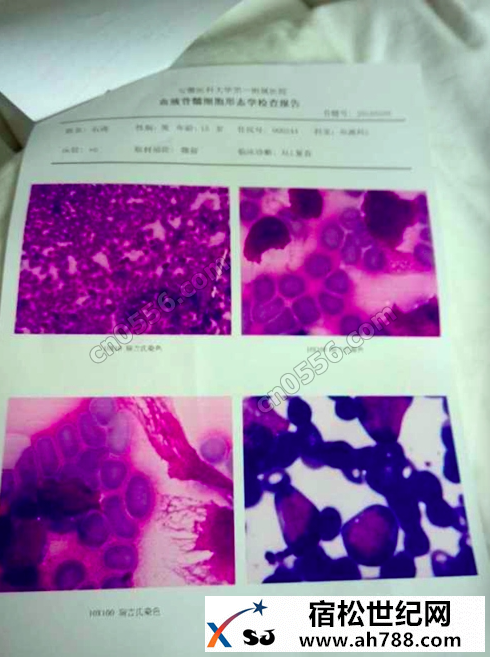 2B4FD8E7-054D-45B8-9B8D-715A77D53211.png