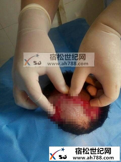 xI3qr4cvE5dS_副本.jpg