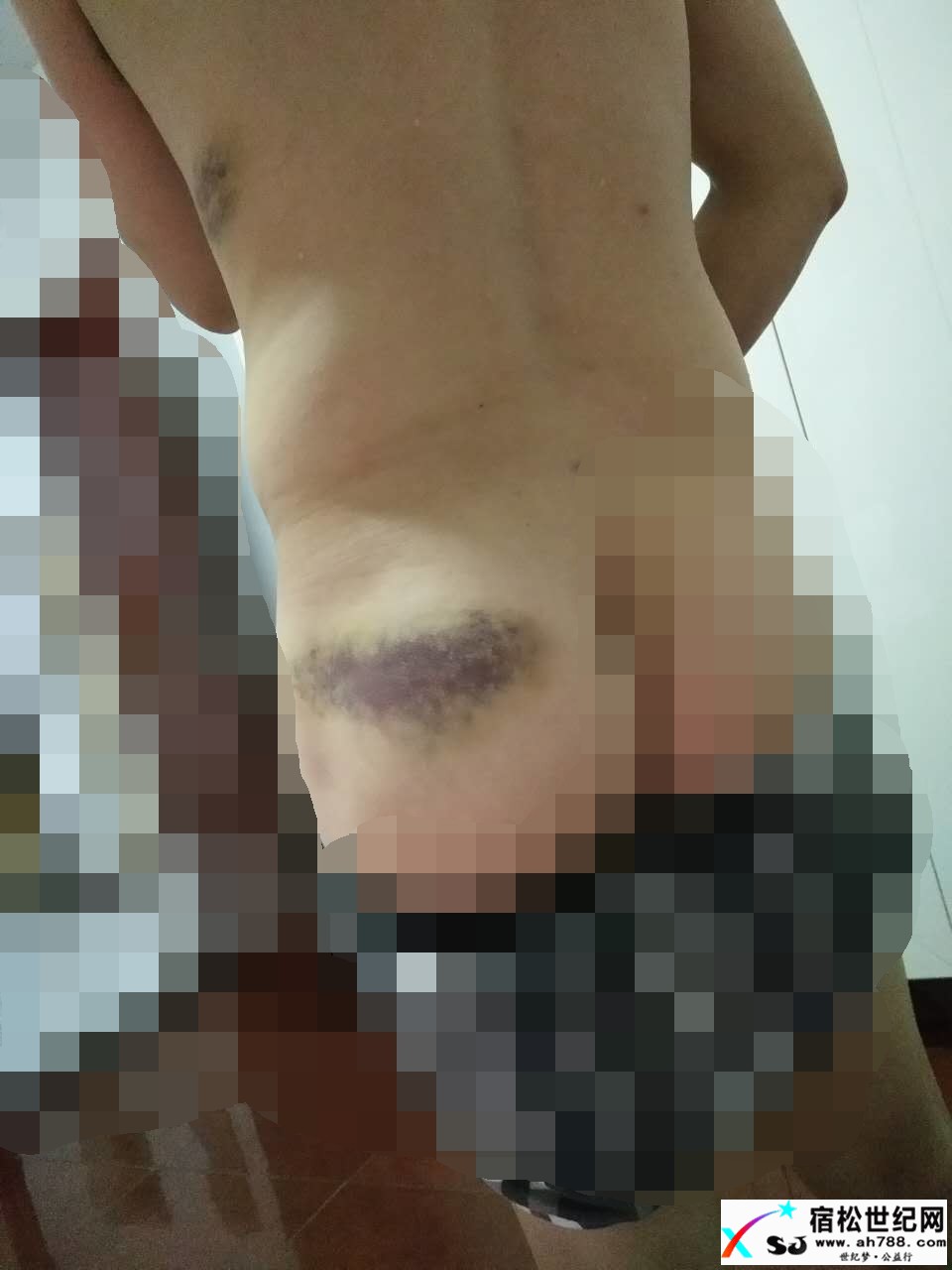 被害者