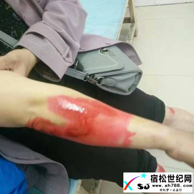 175814br8rr86lefd86am9.jpg