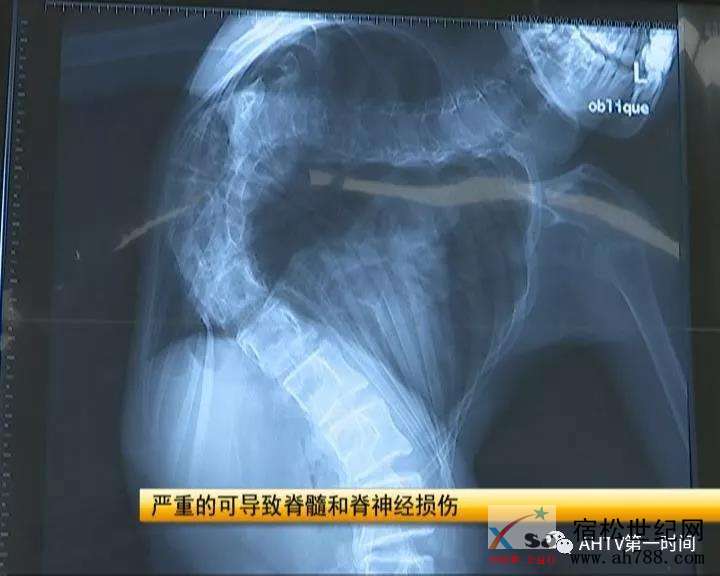 微信图片_20181113175638.jpg