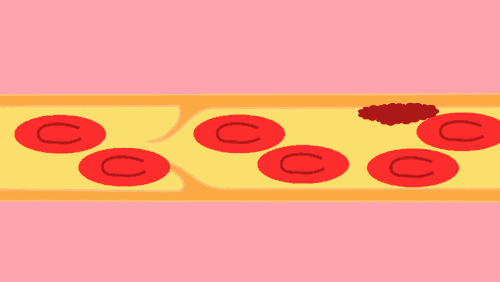2·11.gif